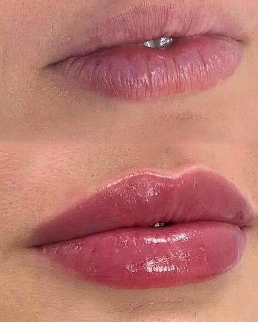 Lip Blush-Permanent Makeup